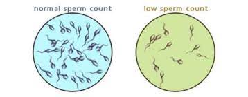 what is sperm count