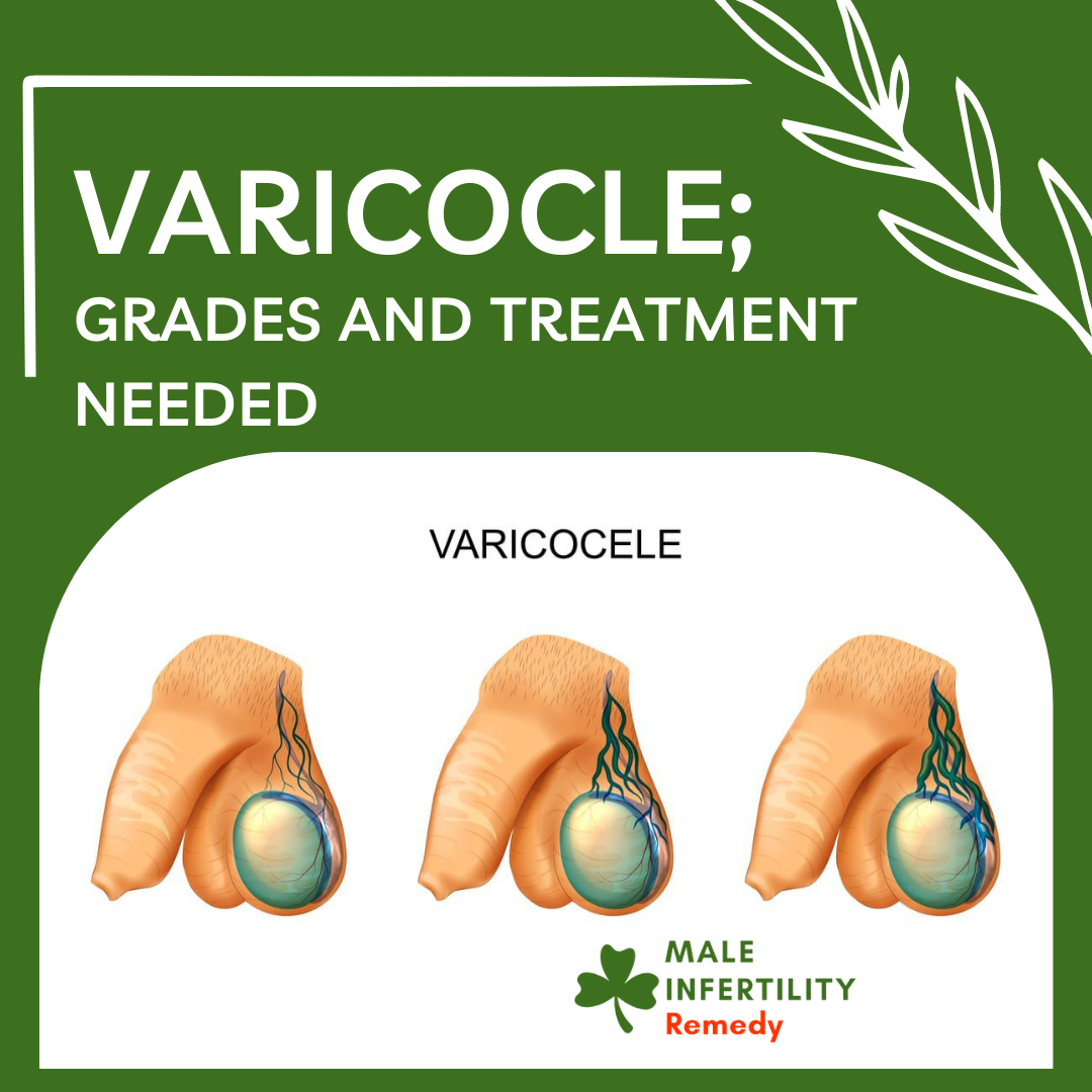 Varicocele: Grades and Treatment Needed - Male Infertility Remedy